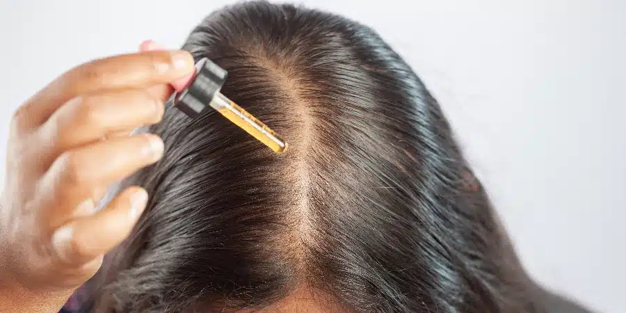 Mulher aplicando Minoxidil Corretamente